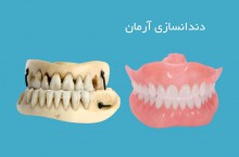 بهترین دندانسازی در تهران