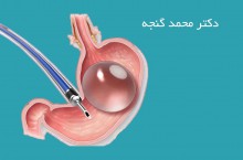 جراحی چاقی و لاپاراسکوپی و بوتاکس معده در تهران
