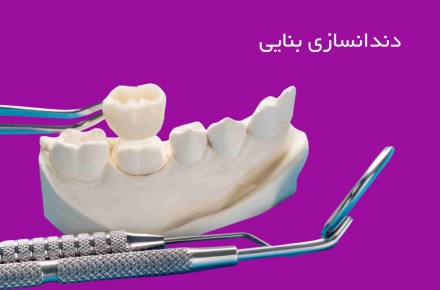 دندانسازی شمال غرب تهران - 1