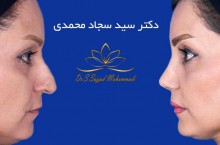 دکتر سجاد محمدی جراح عالی پلاستیک و زیبایی در تهران