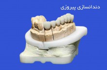 لابراتوار دندانسازی پیروزی