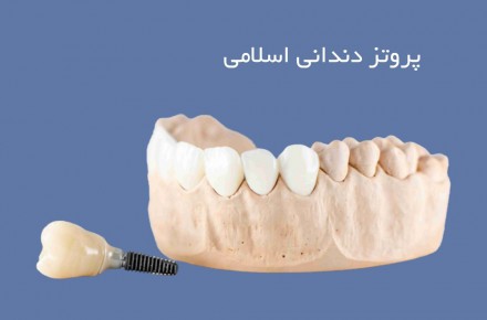 پروتز دندانی اسلامی - 1
