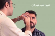 طراحی و ساخت پروتز چشم در استان فارس