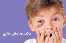 بهترین جراح اربیت چشم در تهران