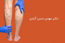 درمان واریس با لیزر و تزریق در تهران دکتر مهدی حسن آبادی